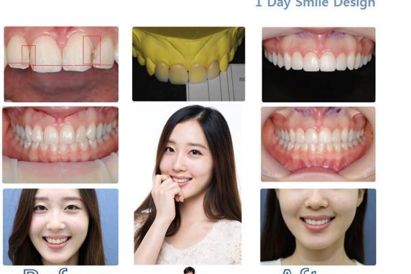11 seoul guide medical dental patients (43)