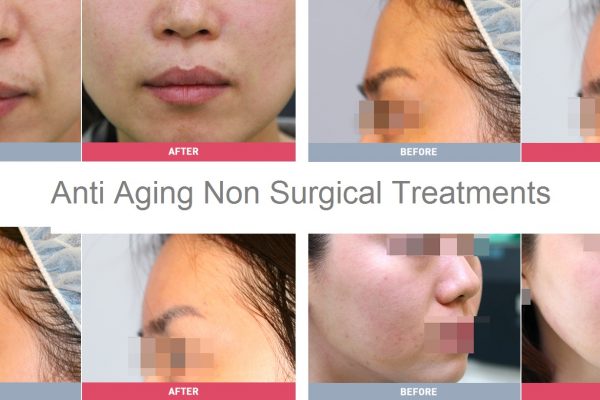 17 skin care before and after anti aging seoul guide medical
