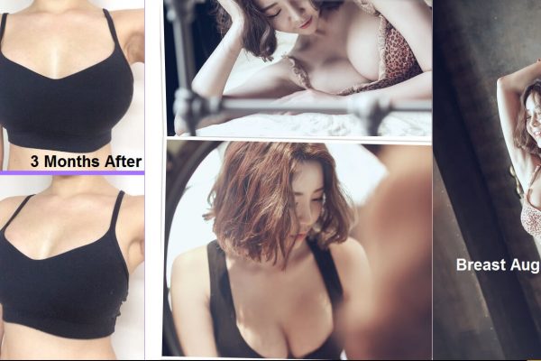 15 breast augmentation via implants before and after seoul guide medical